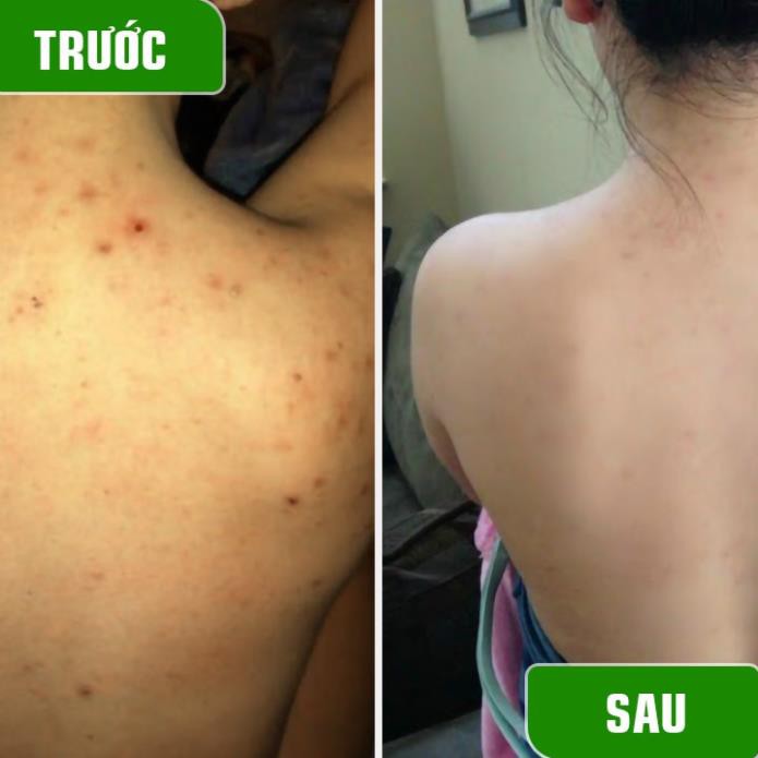 Xà phòng làm sạch mụn lưng Tiệm Mộc 130gr dạng bánh hương thơm hoa trái | BigBuy360 - bigbuy360.vn