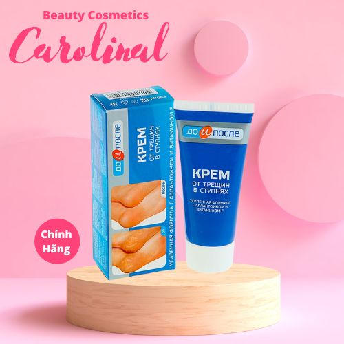 Kem nẻ gót chân Kpem Apteka Nga dưỡng da chân,Ngăn Ngừa Và Hồi Phục Nứt Nẻ Gót Chân 50ml