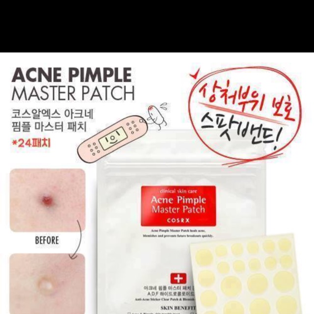 .Miếng dán hút mụn sưng Cosrx Acne Pimple Master Patch