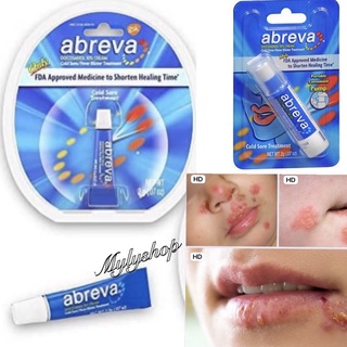 Kem bôi mụn rộp quanh miệng Abreva 2g