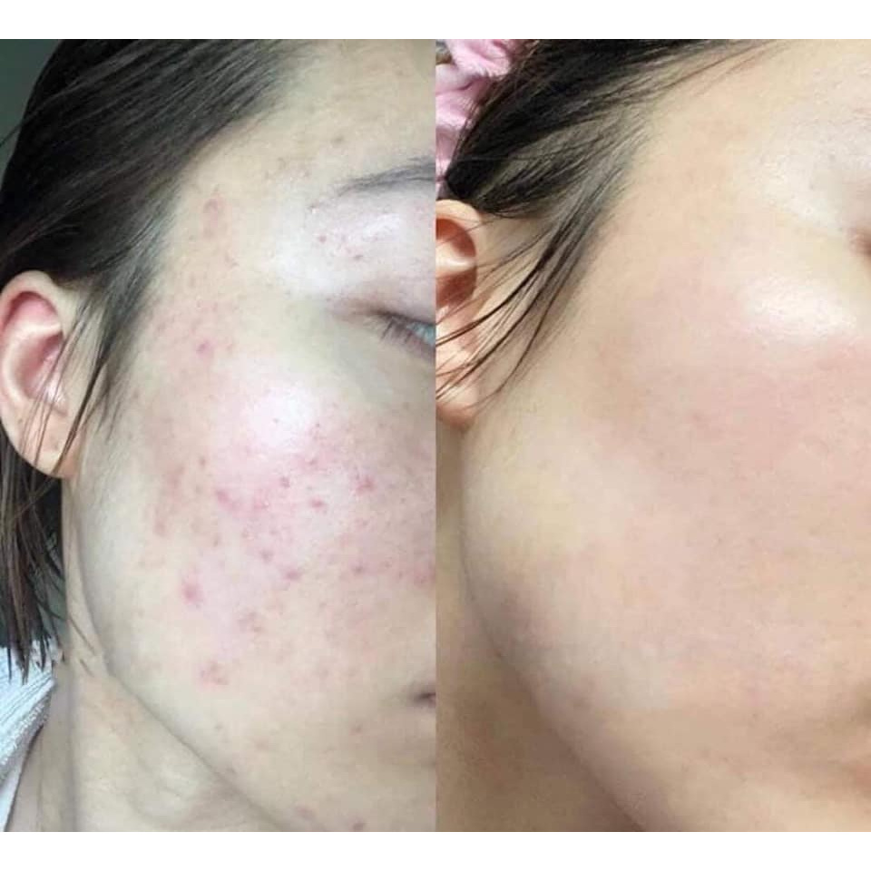 Viên bổ sung Vitamin C 1000mg Làm Đẹp Da 150 viên Nutri D-Day Hàn Quốc | Thế Giới Skin Care