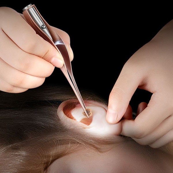 Nhíp ráy tai chuyên dụng có đèn soi 👂 𝙎𝙄𝙀̂𝙐 𝙃𝙊𝙏 👂 có hộp, dễ sử dụng, chất liệu cao cấp siêu bền