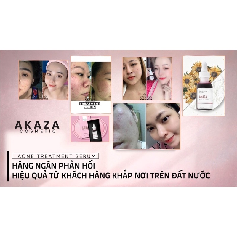 𝐒𝐄𝐑𝐔𝐌 𝐃𝐄𝐓𝐎𝐗 𝐓𝐑𝐈̣ 𝐌𝐔̣𝐍 𝐀𝐊𝐀𝐙𝐀 | BigBuy360 - bigbuy360.vn