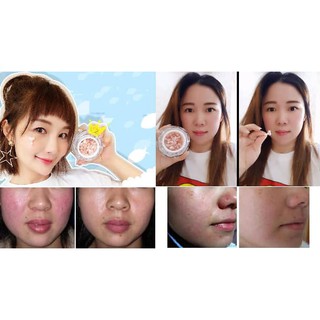 SERUM SỤN MŨI CÁ HỒI RECORE DDS