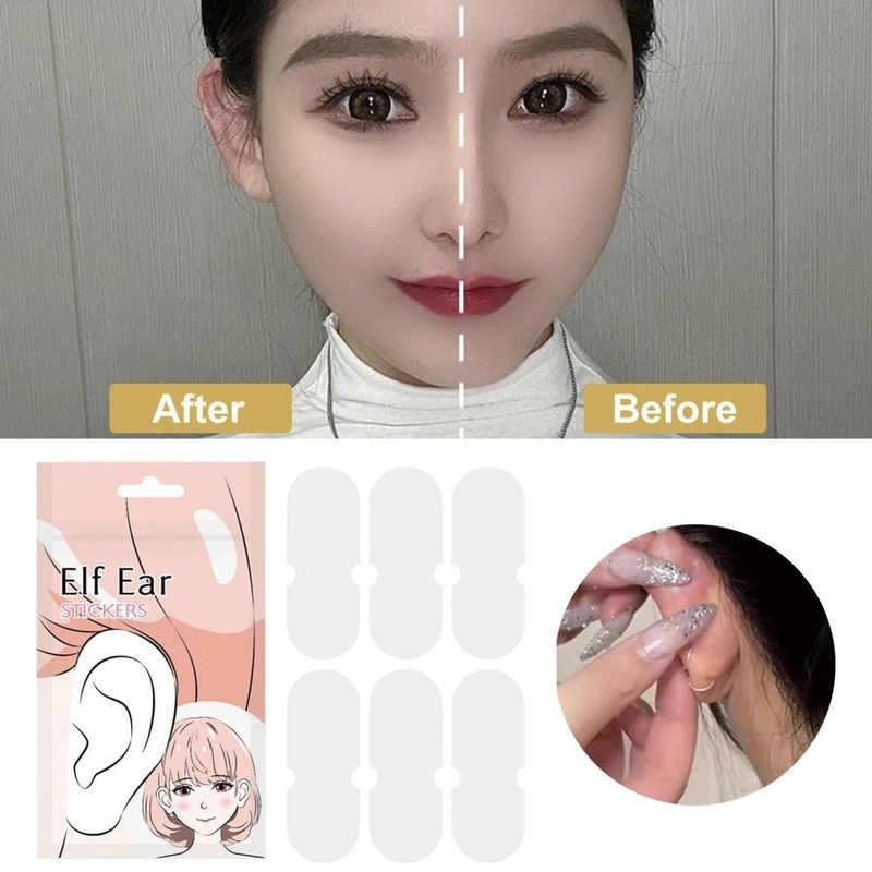 [Hot Promos] Miếng Dán Chỉnh Sửa Lỗ Tai / Chỉnh Sửa Tai Đứng / Chỉnh Sửa Lỗ Tai Hình Chữ V