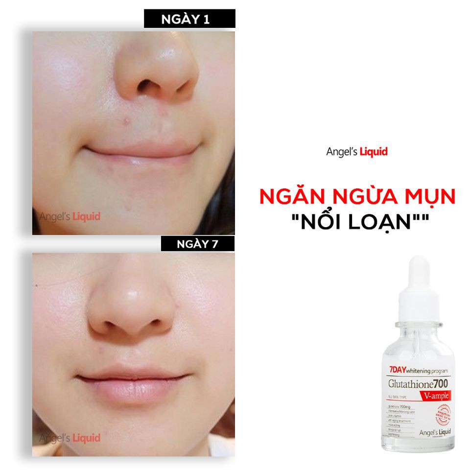 Bộ Kit Angel's Liquid 7Day Dưỡng Sáng Da, Mờ Thâm Nám 4 Món Whitening Program Glutathione Special Kit | BigBuy360 - bigbuy360.vn