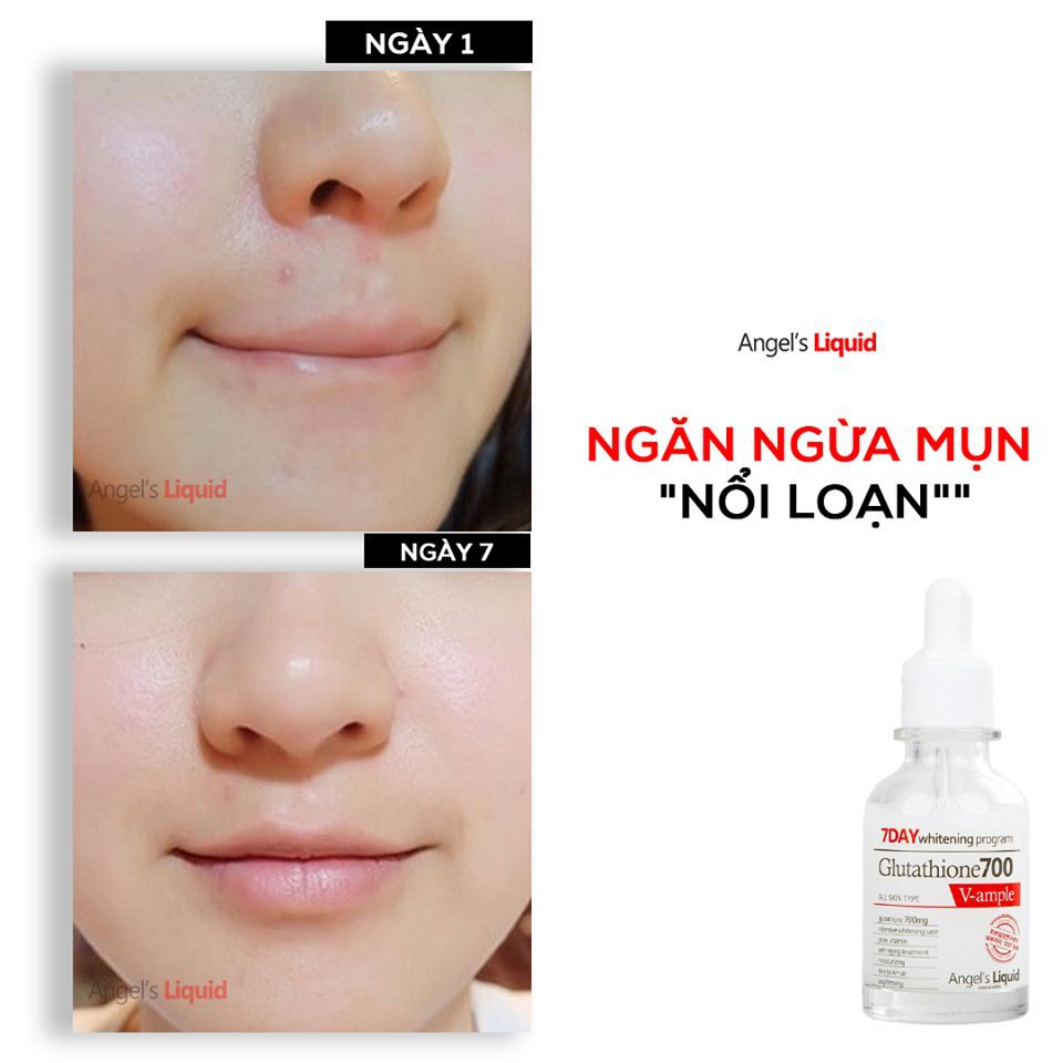 Bộ 3 Sản Phẩm Dưỡng Trắng Da 7Day Angel Liquid Whitening Program Gutathione 700V ( Toner &amp; Serum &amp; Kem Dưỡng)