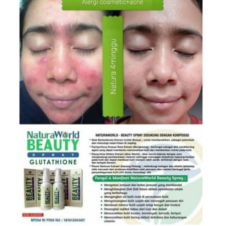 Xịt làm đẹp Natura 100% chính hãng NBS | BigBuy360 - bigbuy360.vn