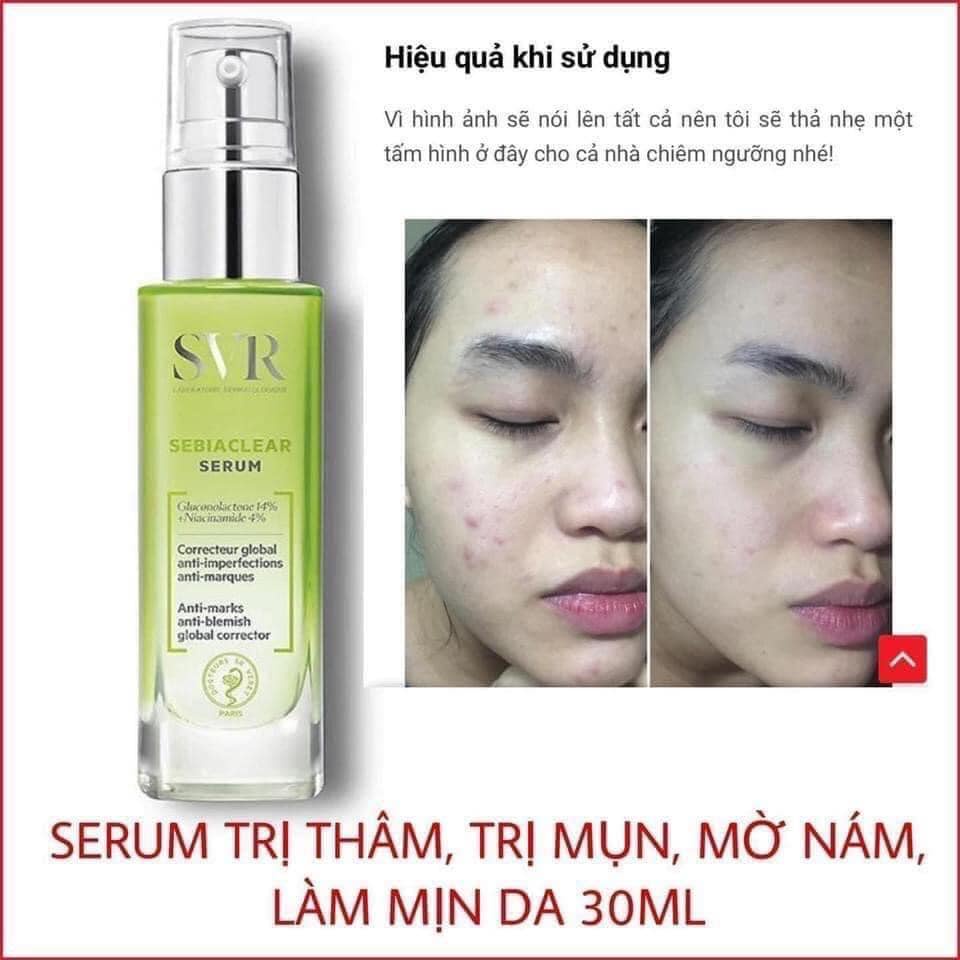 Kem / Serum SVR Sebiaclear giảm mụn, mờ thâm - hàng Pháp