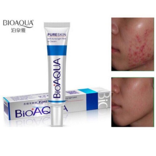 Kem đánh bay Mụn Trứng Cá Pure Skin Bioaqua-hd247