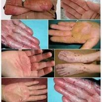 Kem bôi thảo dược Zudaifu