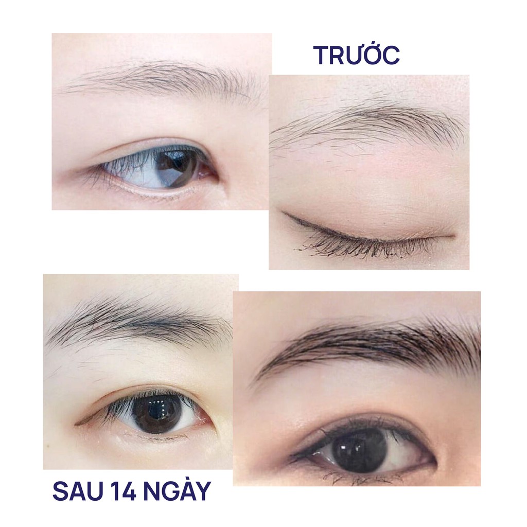 Serum dưỡng mày FEG giúp lông mày dày đẹp tự nhiên sau 14 ngày_FEG Eyebrow Enhancer kích mọc mày dài dày đen | BigBuy360 - bigbuy360.vn