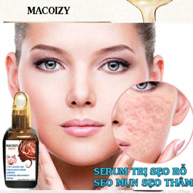 Serum Sẹo Rỗ Tái Tạo Da Se Khích Lỗ Chân Lông