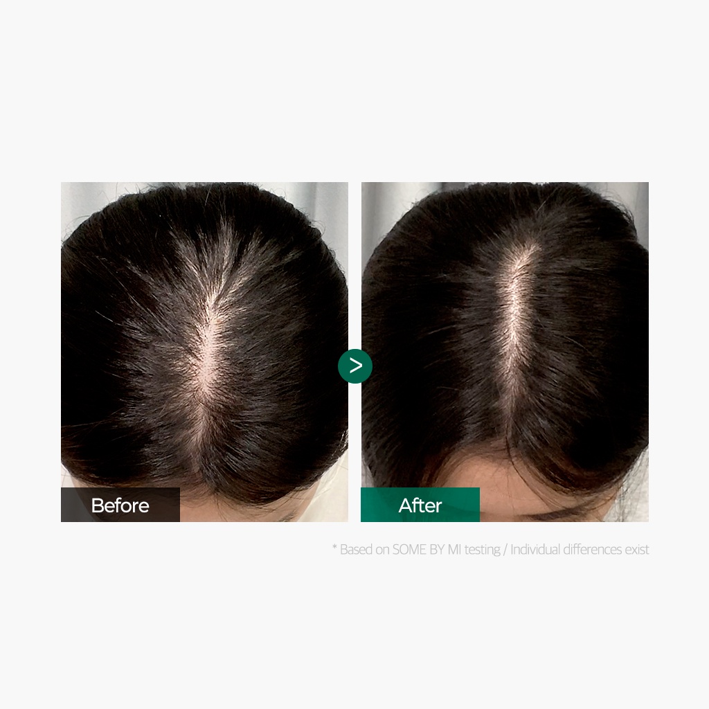 Xịt dưỡng tóc Some By Mi Cica Peptide nuôi dưỡng tóc/ da đầu chống rụng tóc 150ml