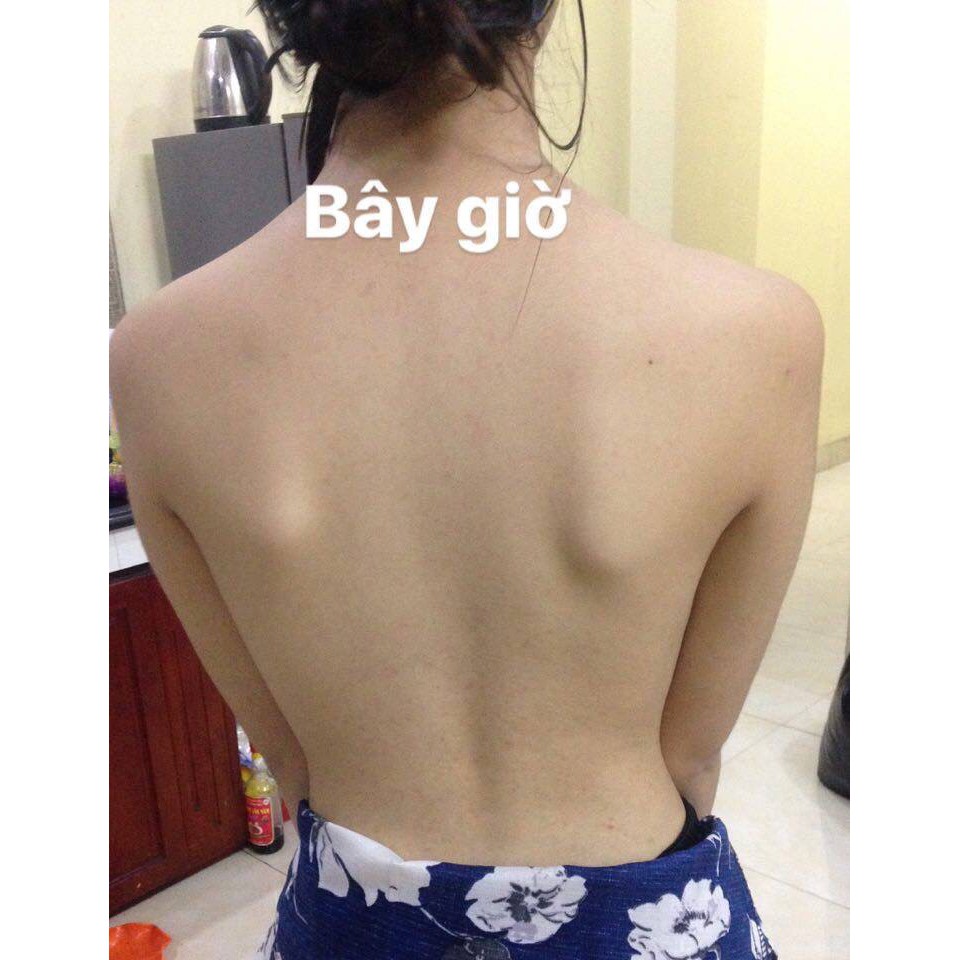 [Auth] Xà bông For Back, xà bông đánh bay mụn lưng Pelican For Back Medicated Soap