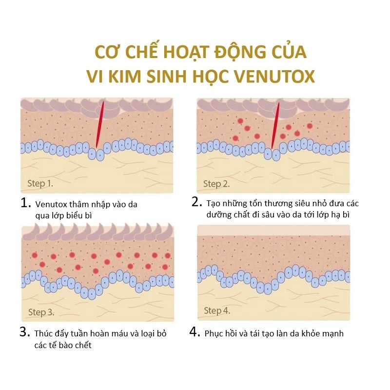 Siêu vi kim trẻ hoá da Venutox 5ml