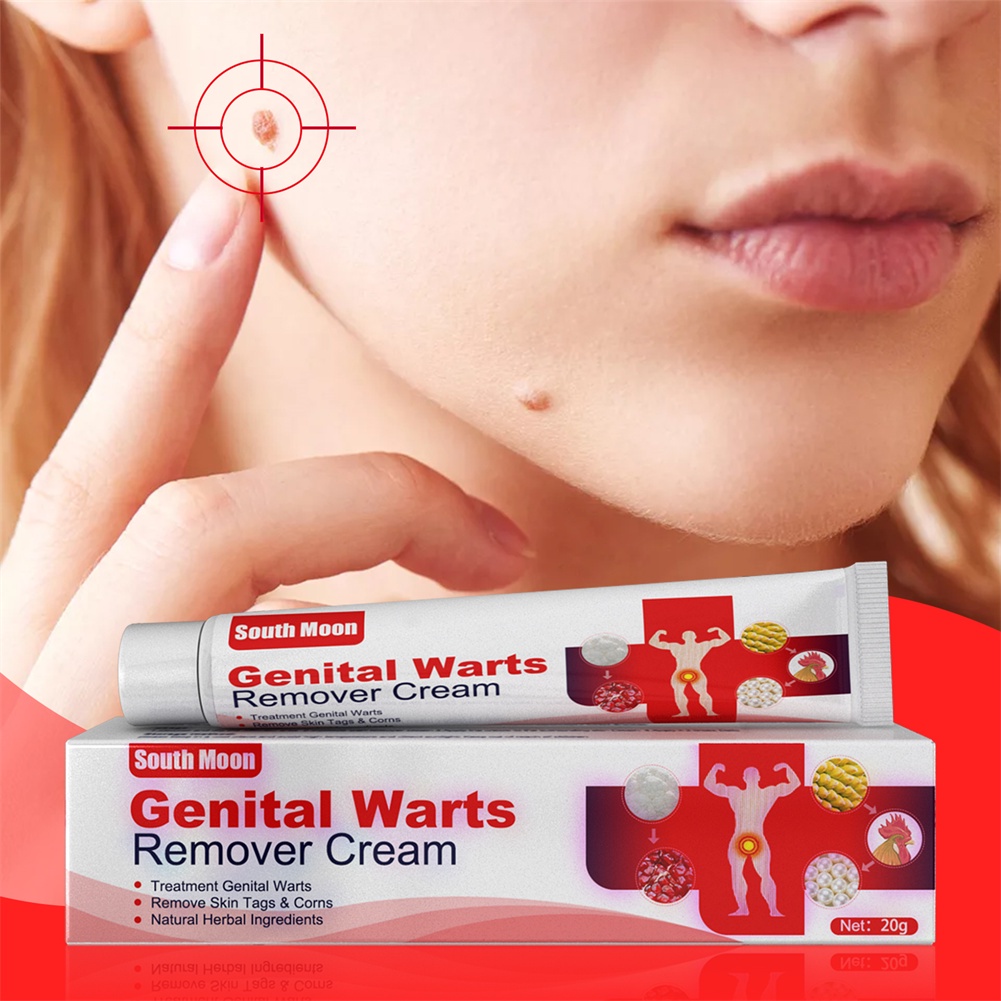 Kem Trị Mụn Thịt Dư Trên Da 20g South Moon Genital Herpes