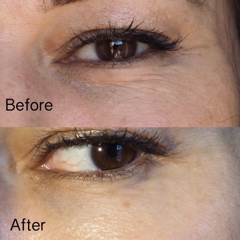 Tinh chất Copper Peptide  ✅ freeship ✅ giúp trẻ hoá da, phụ.c hồ.i da sau lăn kim