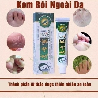 Kem viêm da vảy nến á sừng
