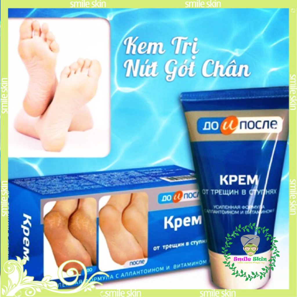(100% chính hãng) kem trị nứt gót chân, dưỡng da chân của NGA