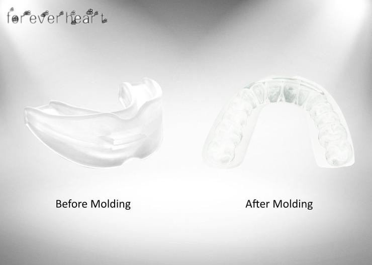 Miếng ngậm miệng chống ngáy chống nghiến răng chăm sóc miệng