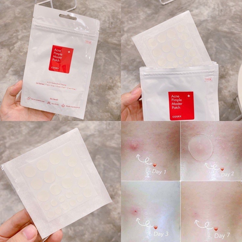 (Auth Hàn) Miếng dán mụn COSRX Acne Pimple Master Patch 24 Miếng