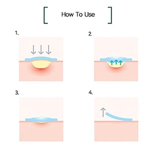 Some BY MI Clear Spot Patch 18 Miếng x 10