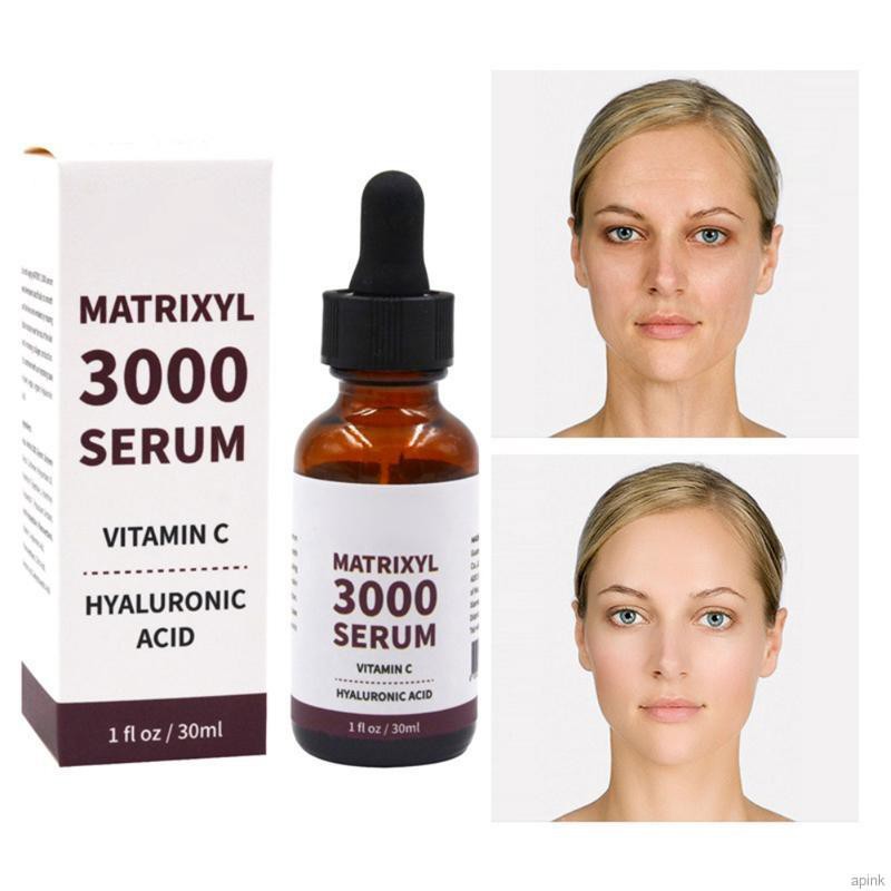 Serum Hyaluronic Acid MATRIXYL 3000 Vitamin C Giảm Nếp Nhăn Chăm Sóc Da Mặt 30ml