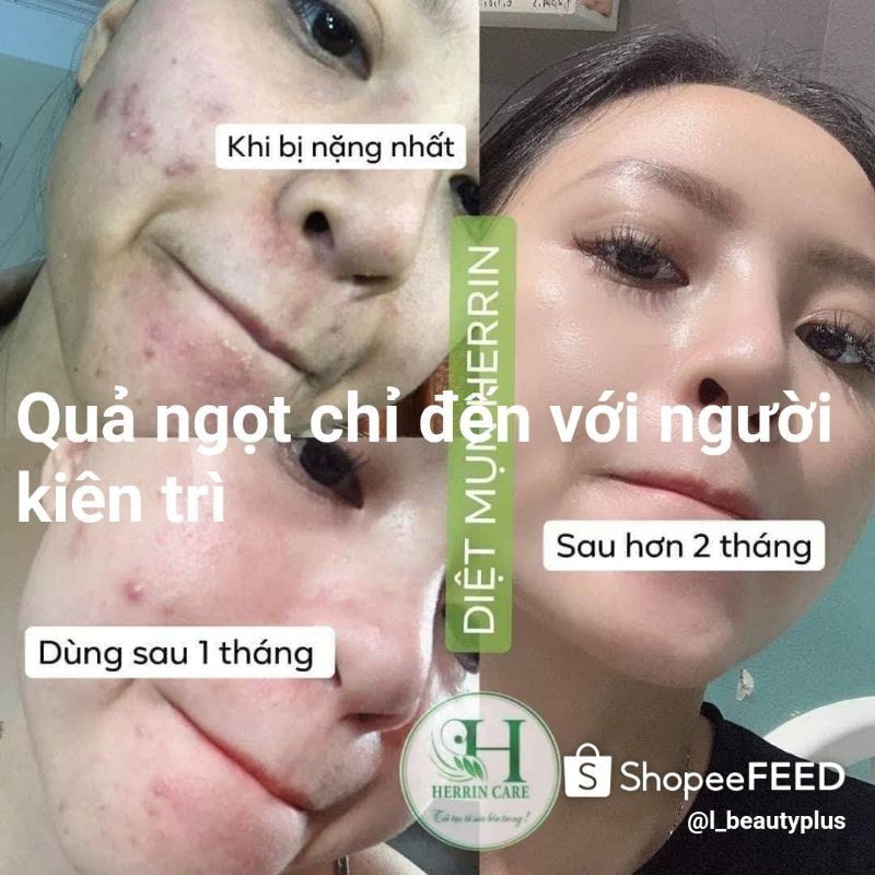 SỮA RỬA MẶT TẠO BỌT HERRIN CARE CLEANSING FOAM 100ML | BigBuy360 - bigbuy360.vn