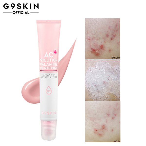 KEM GIẢM MỤN, GIÚP GIẢM SƯNG, LÀM DỊU NỐT MỤN HIỆU QUẢ G9SKIN AC SOLUTION CALAMINE GEL SPOT PATCH 20G CHÍNH HÃNG - 9876