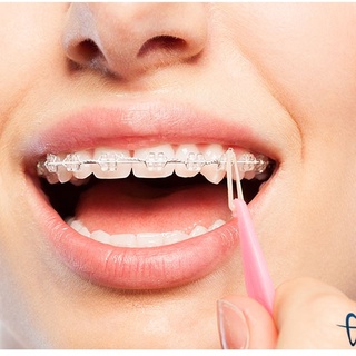 100 Cây móc chun liên hàm-cây móc thun niềng răng