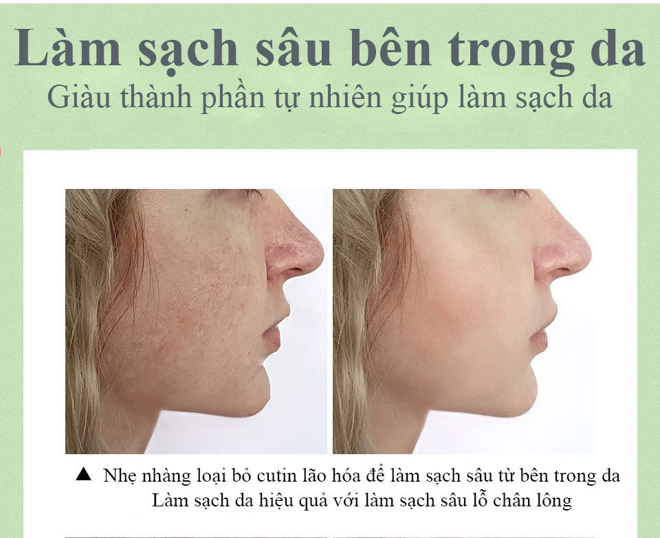 [CHÍNH HÃNG] VIBRANT GLAMOUR SỮA RỬA MẶT CHIẾT XUẤT BƠ DƯỠNG ẨM TRẮNG DA LÀM SẠCH DA KIỂM SOÁT DẦU THU NHỎ LỖ CHÂN LÔNG