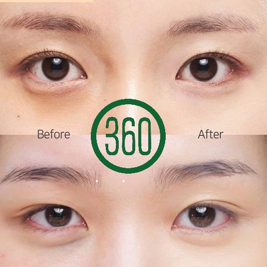 Kem Che Khuyết Điểm Vùng Da Quanh Mắt Innisfree My Concealer Dark Circle Cover 7g