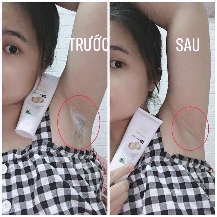 Combo Kem Triệt Râu Ria, Lông Vĩnh Viễn Không Mọc Lại Tặng kèm serum ức chế mọc lại ( Chính hãng 100%)