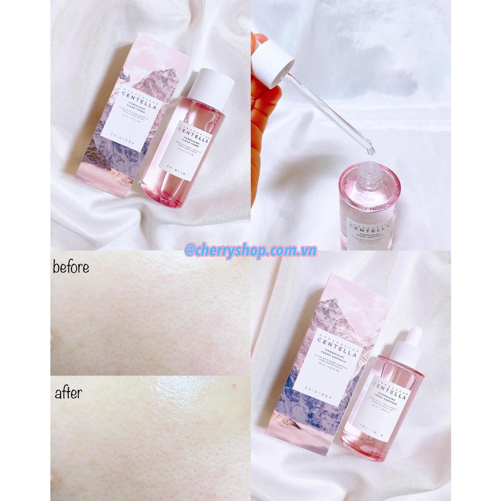 Bộ dưỡng da SKIN1004 Madagascar Centella Poremizing