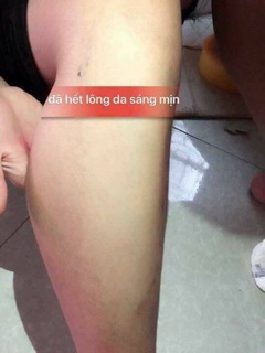 Triệt lông nelly.p( feeship)
