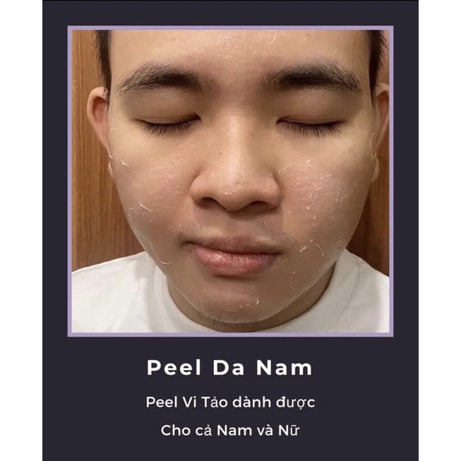 Sỉ 5 chai peel mặt vi tảo