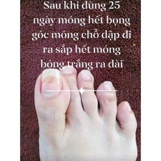 Dung Dịch Nấm Móng ,Phục Hồi Móng Hư Tổn (1 chai)