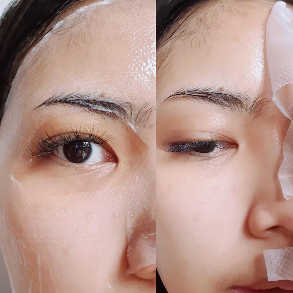 Mặt nạ ống tiêm cấp nước MIRAE cho da cải thiện giúp da căng mịn sáng bóng 1.5ml/ống, 20ml / miếng | BigBuy360 - bigbuy360.vn