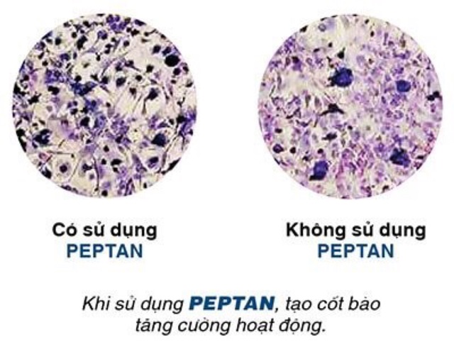 ✅  JEX MAX Viên uống hỗ trợ điều trị viêm khớp - bổ khớp, tái tạo sụn khớp,