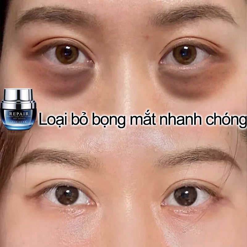Kem mắt dưỡng mắt kem mắt chống lão hóa Loại bỏ quầng thâm mắt Kem dưỡng ẩm vùng mắt kem chống nhăn loại bỏ bọng mắt