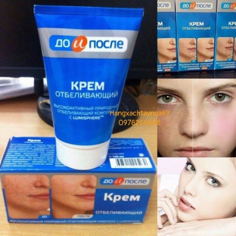 Kem nám tàn nhân Kpem Nga làm mờ nám tàn nhan đồi mồi dưỡng ẩm da date mới