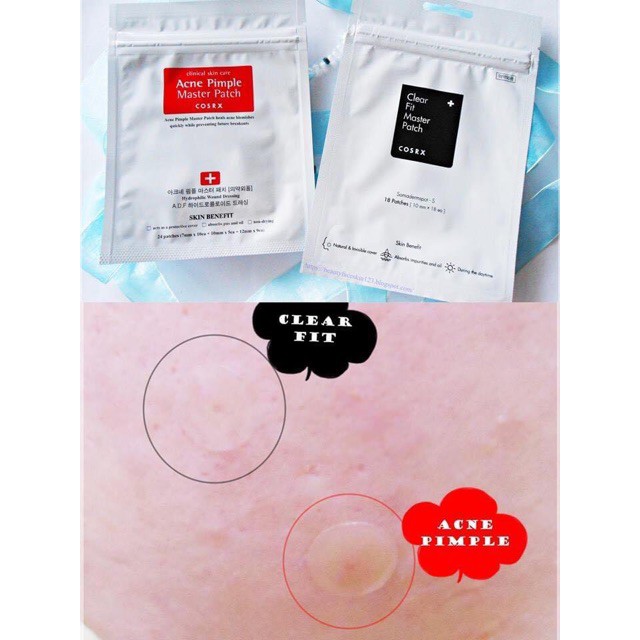 Miếng Dán Mụn Cosrx Acne Patch Các Loại