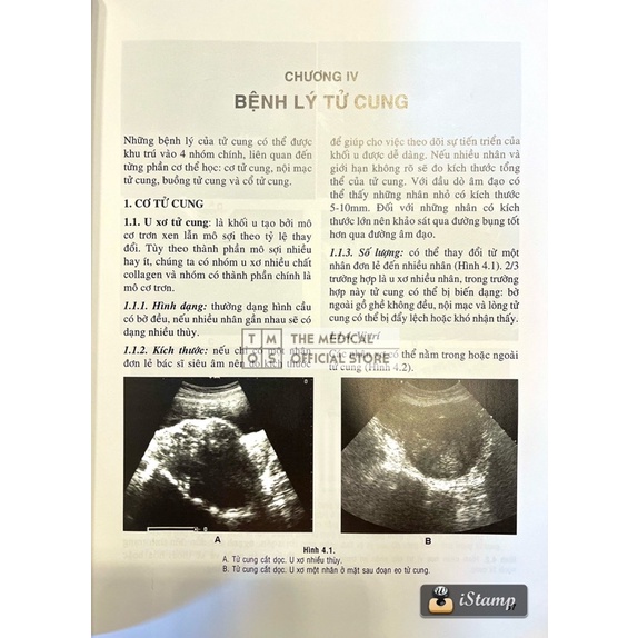 Sách - Siêu Âm Sản Phụ Khoa Thực Hành Tmos