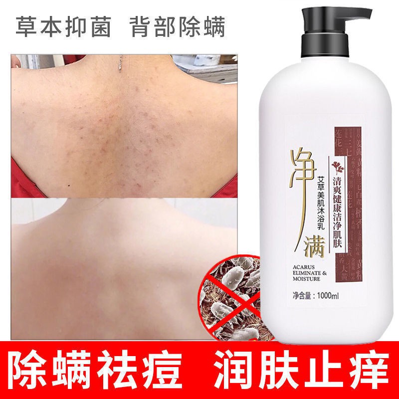 (Hàng Mới Về) Gel Tắm Chiết Xuất Nha Đam 1000ml Trị Mạt Và Mụn Trứng Cá