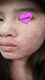 Thảo dược Đông y Sắc Mộc Lan