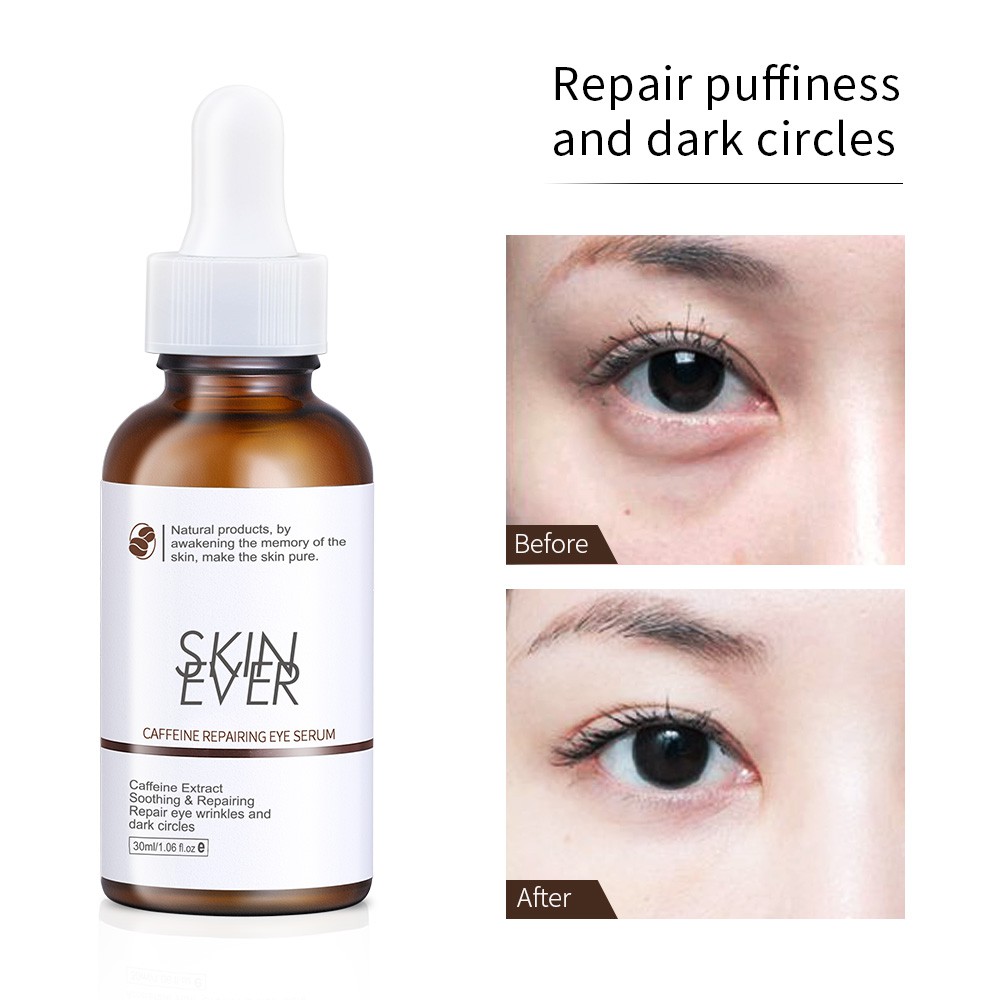 Serum SKIN EVER chiết xuất cây trà/ nho biển giữ ẩm/ rau má/ cà phê loại bỏ quầng thâm 30ml