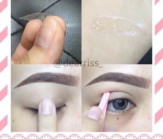 Kích mí lưới