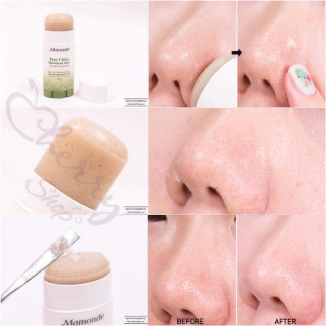 🍒THANH LĂN HÚT MỤN PORE CLEAN BLACKHEAD STICK