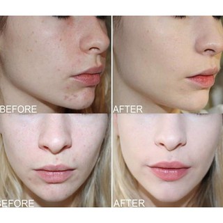 Toner sáng da, mờ thâm Mentholatum CC Melano